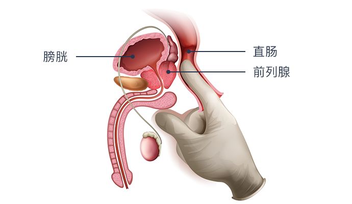 前列腺保养了解一下